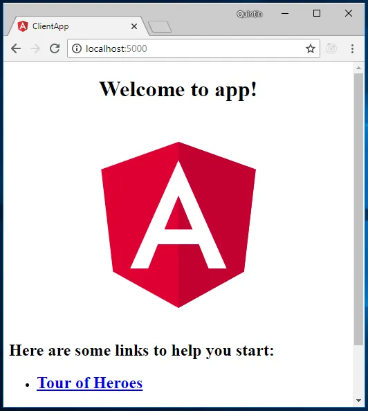 The browser at localhost showing the new Angular app’s “Welcome to app!” page
